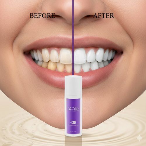 Before After Teeth Close Up